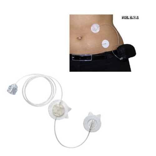 Sure-T® Infusion Set