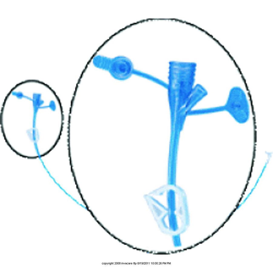 MIC-KEY® Extension Set with Secur-Lok™