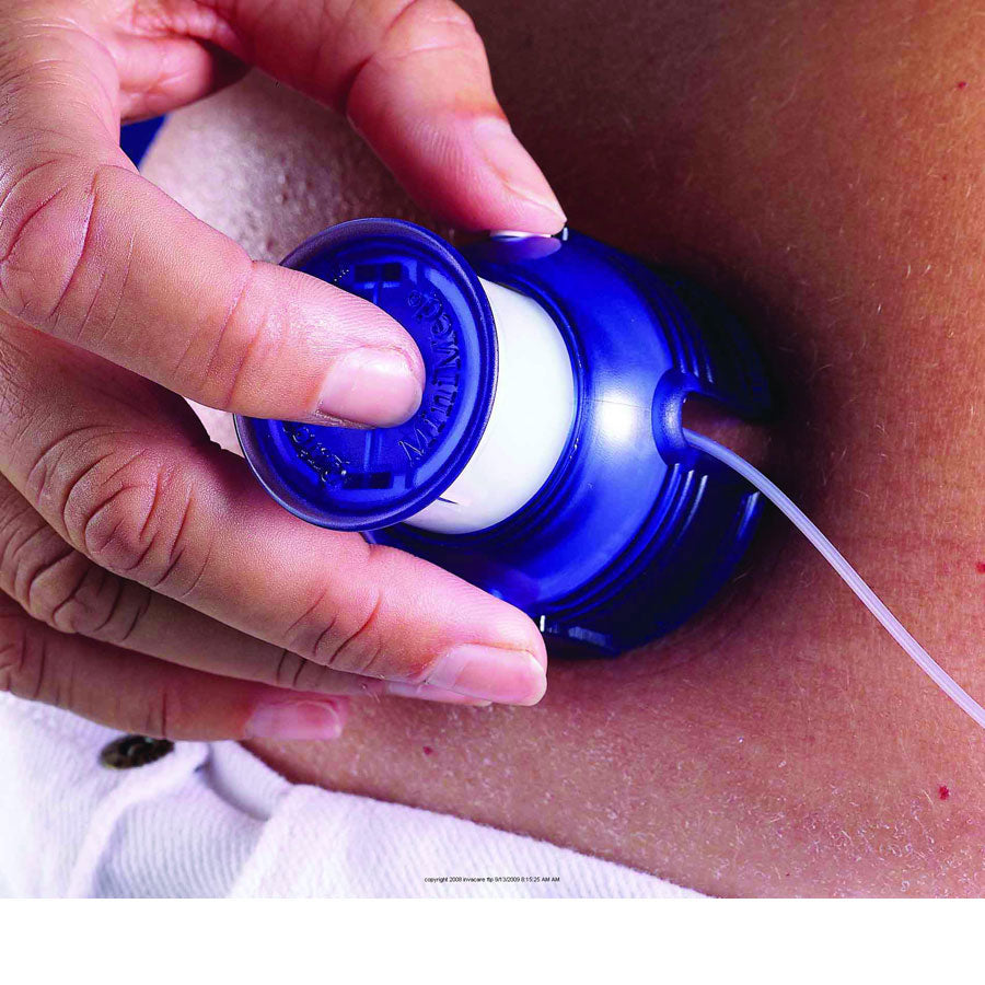 Quick-serter™ Silhouette Insulin Delivery