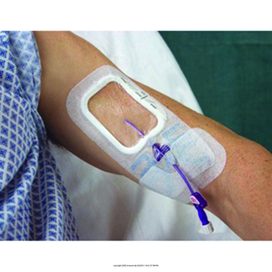 SorbaView® 2000 Window Dressing